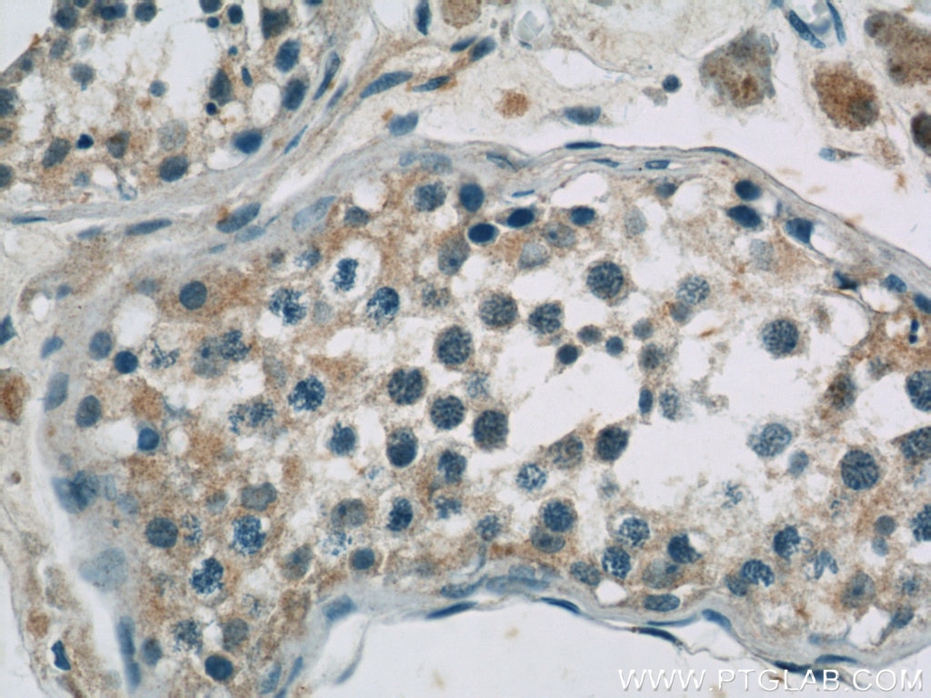 Immunohistochemistry (IHC) staining of human testis tissue using EIF2B4 Polyclonal antibody (11332-1-AP)