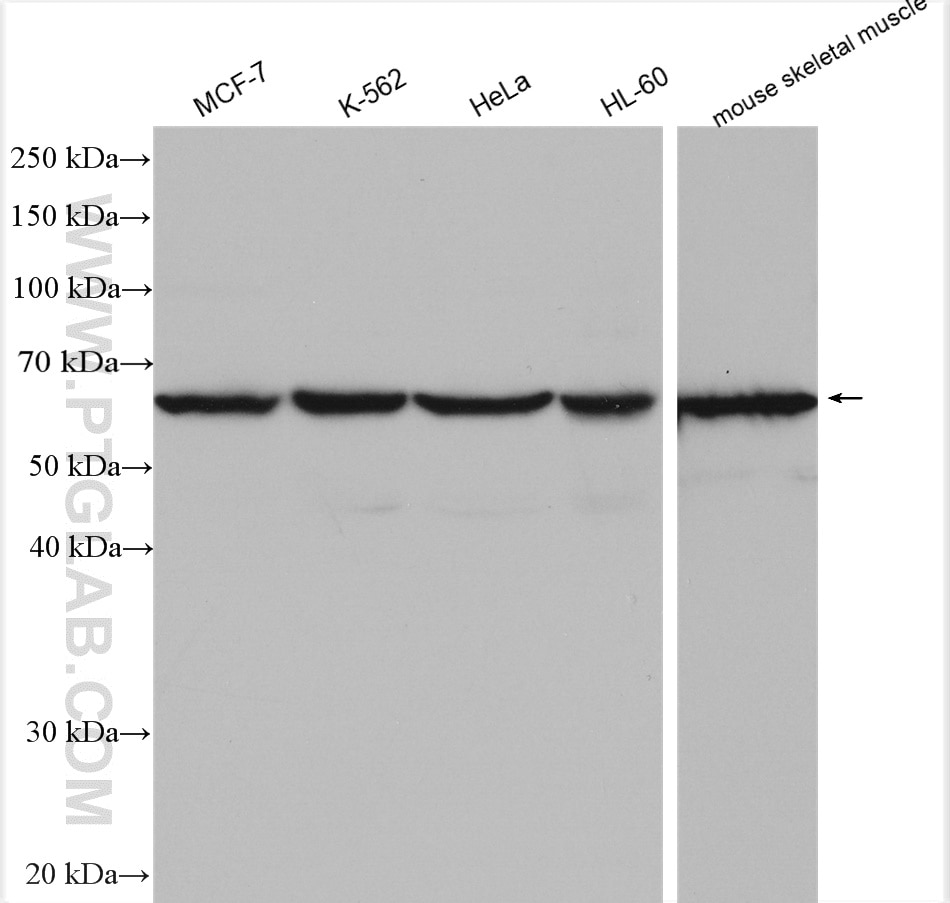 Western Blot (WB) analysis of various lysates using EIF2B4 Polyclonal antibody (11332-1-AP)