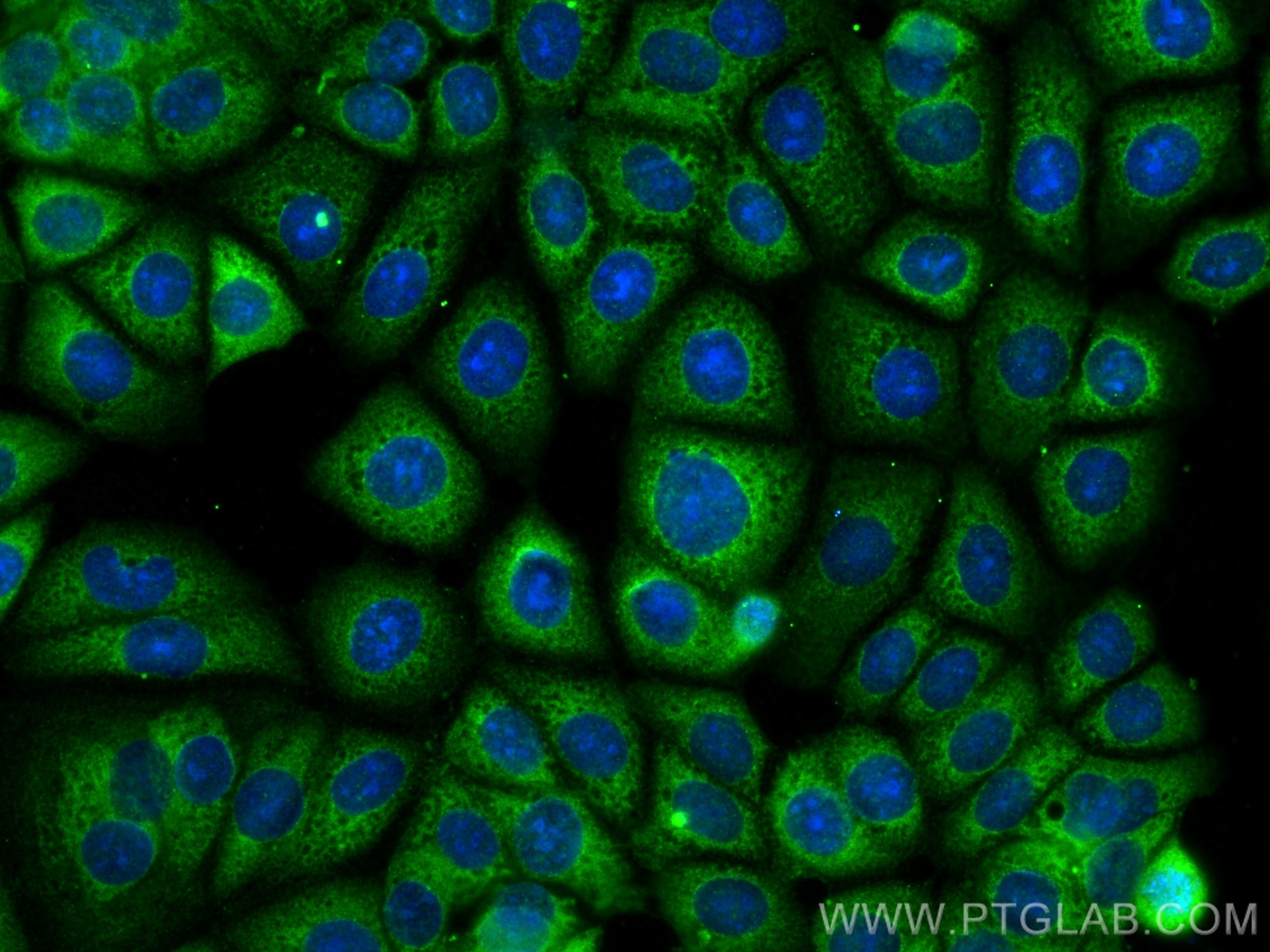 Immunofluorescence (IF) / fluorescent staining of MCF-7 cells using EIF2B5 Polyclonal antibody (29935-1-AP)