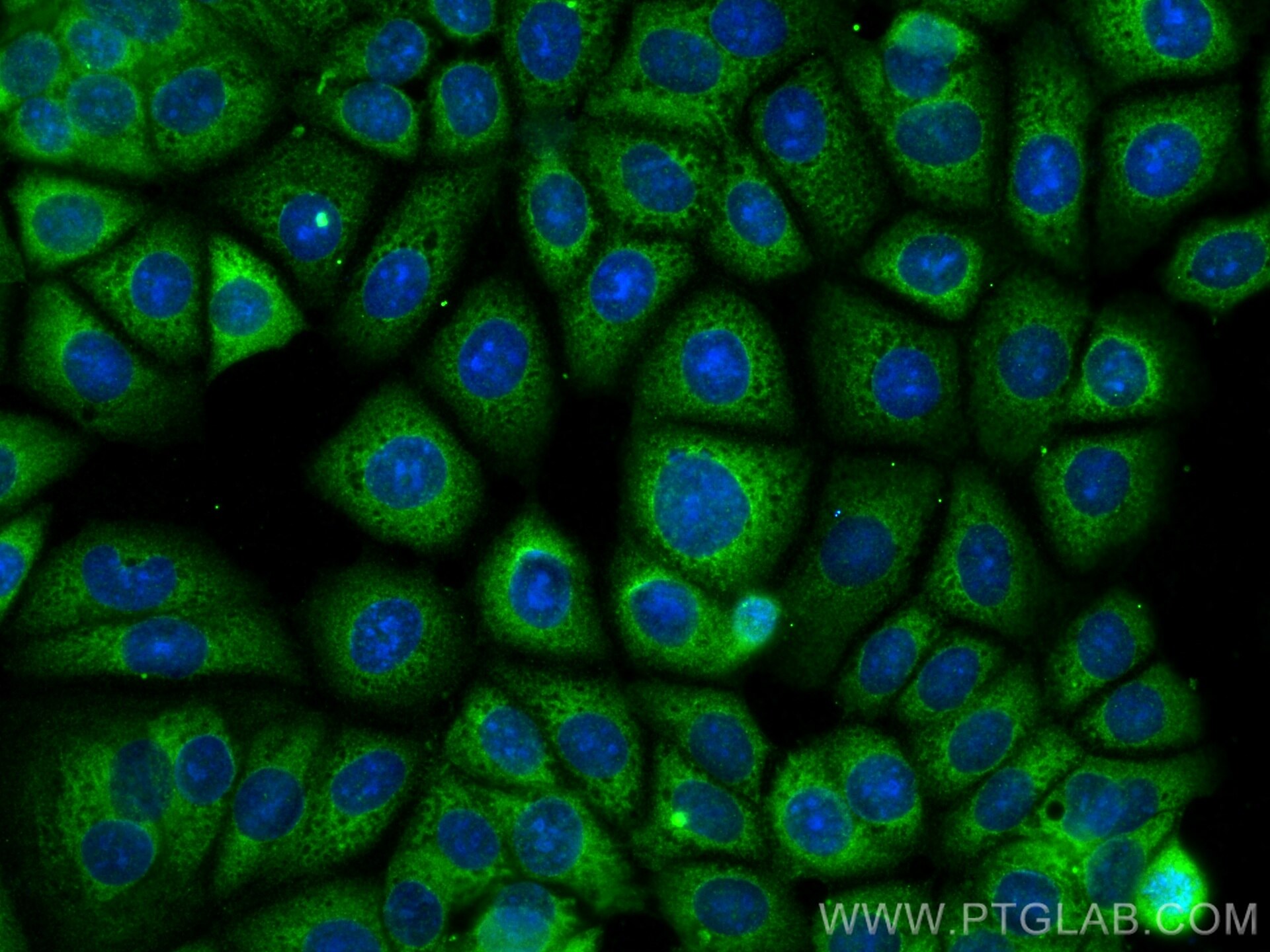 IF Staining of MCF-7 using 29935-1-AP