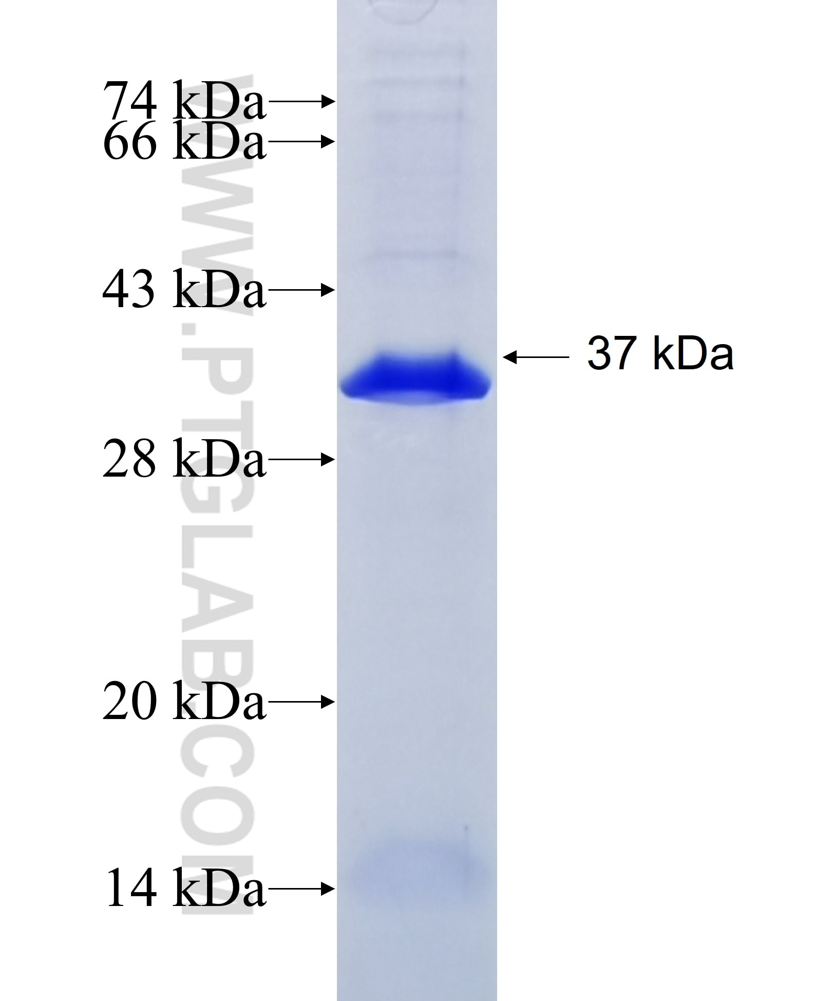 EIF2B5 fusion protein Ag32181 SDS-PAGE EIF2B5 fusion protein Ag32181 SDS-PAGE