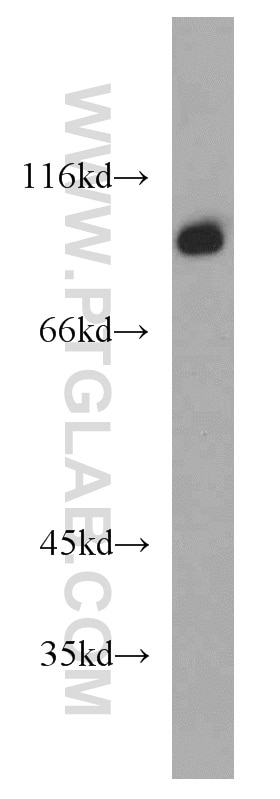 Western Blot (WB) analysis of HeLa cells using EIF2C1-Specific Polyclonal antibody (19690-1-AP)