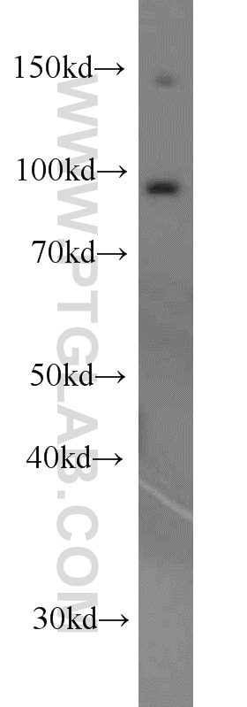 Western Blot (WB) analysis of HeLa cells using EIF2C1-Specific Polyclonal antibody (19690-1-AP)