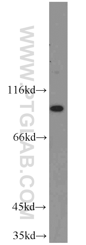 Western Blot (WB) analysis of HeLa cells using EIF2C1-Specific Polyclonal antibody (19690-1-AP)