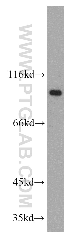 Western Blot (WB) analysis of Jurkat cells using EIF2C1-Specific Polyclonal antibody (19690-1-AP)