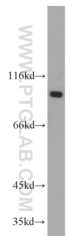 WB analysis of Jurkat using 19690-1-AP