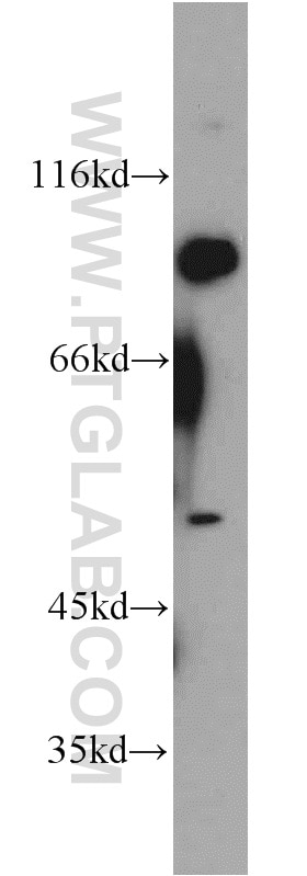 Western Blot (WB) analysis of K-562 cells using EIF2C1-Specific Polyclonal antibody (19690-1-AP)