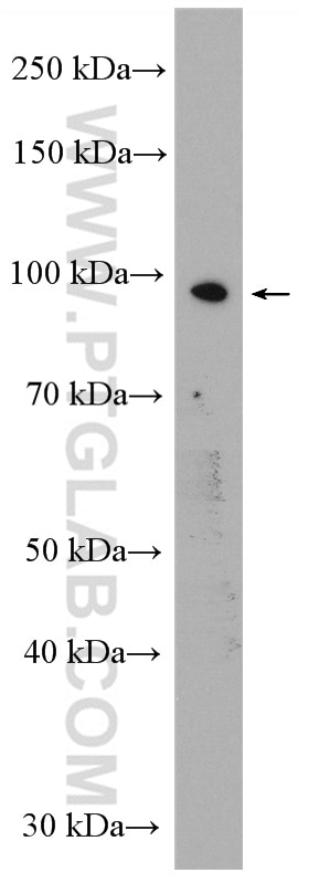 Western Blot (WB) analysis of HEK-293 cells using AGO2 Polyclonal antibody (10686-1-AP)