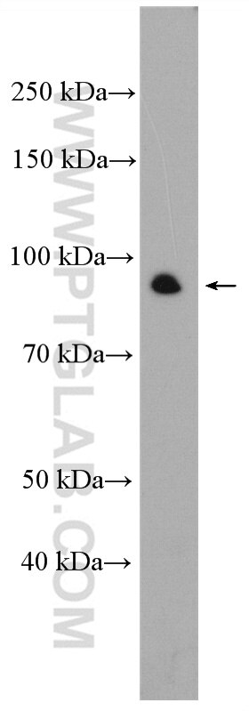 Western Blot (WB) analysis of K-562 cells using AGO2 Polyclonal antibody (10686-1-AP)