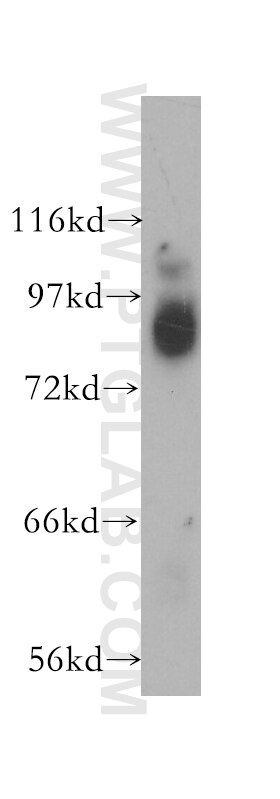 AGO2 Polyclonal antibody