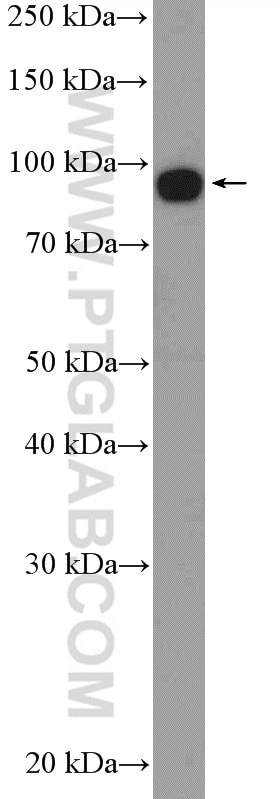 Western Blot (WB) analysis of SKOV-3 cells using EIF2C3-Specific Polyclonal antibody (19692-1-AP)