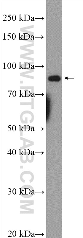 Western Blot (WB) analysis of HepG2 cells using EIF2C3-Specific Polyclonal antibody (19692-1-AP)