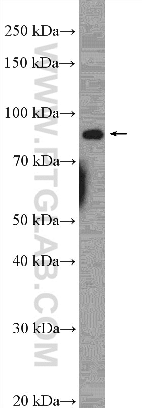 WB analysis of HepG2 using 19692-1-AP