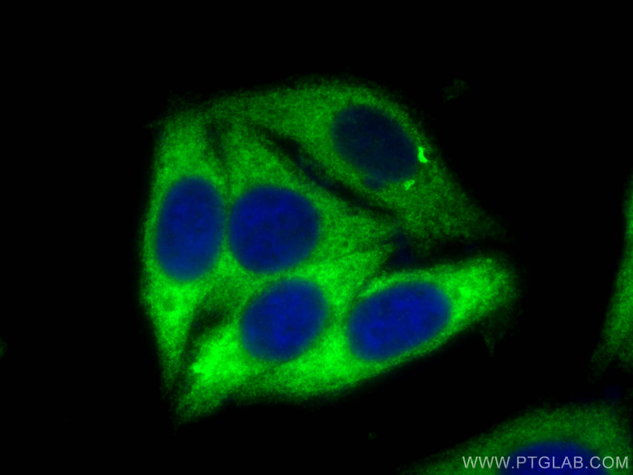 IF Staining of HepG2 using 11170-1-AP