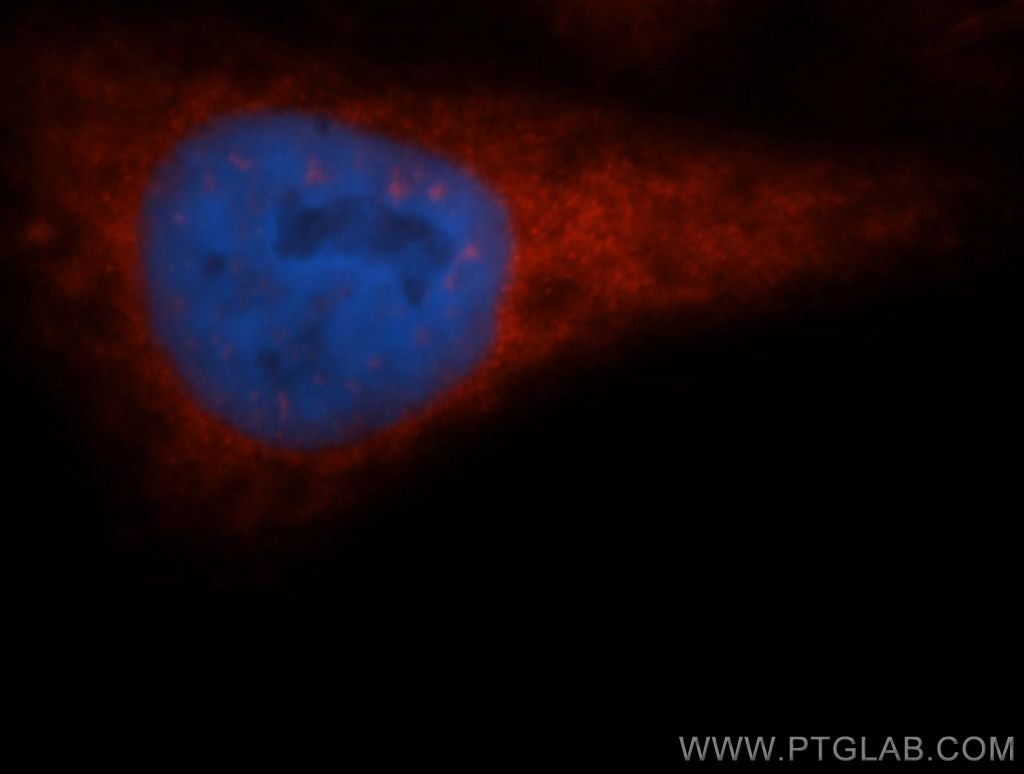 Immunofluorescence (IF) / fluorescent staining of HepG2 cells using EIF2S1/EIF2A Polyclonal antibody (11170-1-AP)