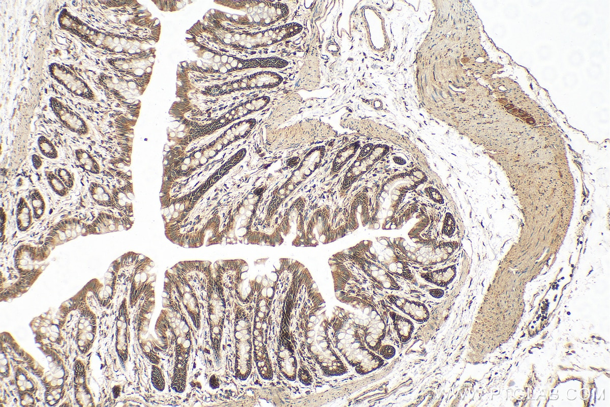 Immunohistochemistry (IHC) staining of rat colon tissue using EIF2S1 Polyclonal antibody (11170-1-AP)