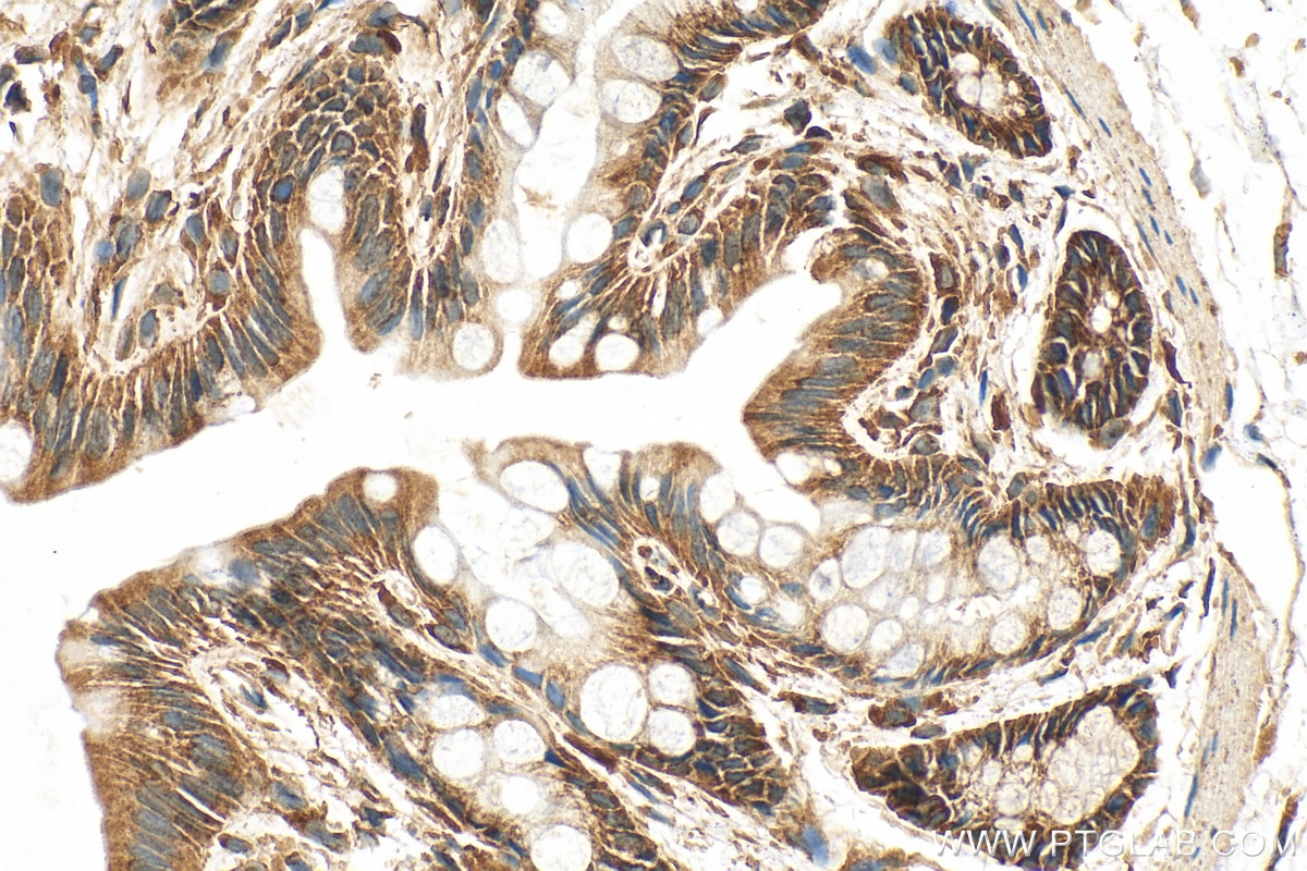 Immunohistochemistry (IHC) staining of rat colon tissue using EIF2S1 Polyclonal antibody (11170-1-AP)