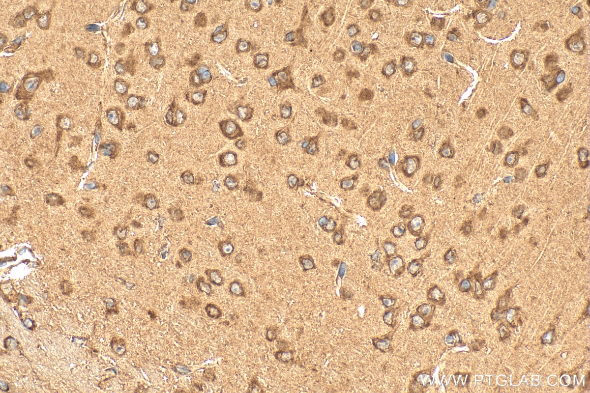 Immunohistochemistry (IHC) staining of mouse brain tissue using EIF2S1 Polyclonal antibody (11170-1-AP)