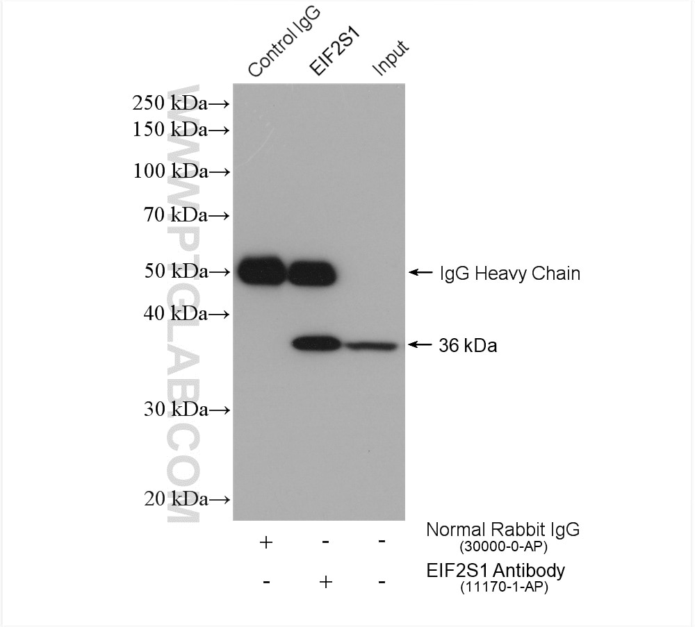 Immunoprecipitation (IP) experiment of HepG2 cells using EIF2S1 Polyclonal antibody (11170-1-AP)