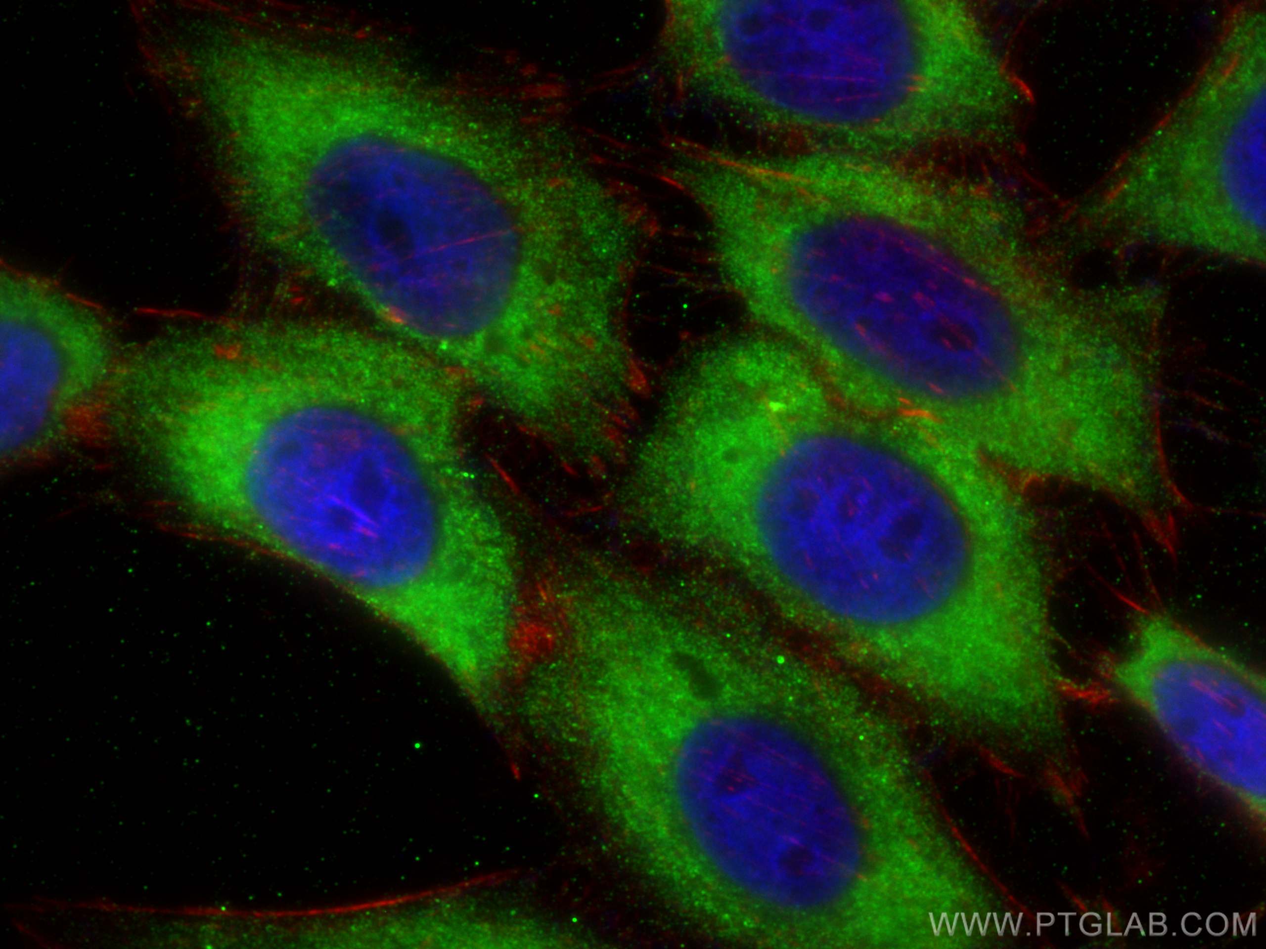 Immunofluorescence (IF) / fluorescent staining of HepG2 cells using EIF2S1 Monoclonal antibody (68479-1-Ig)