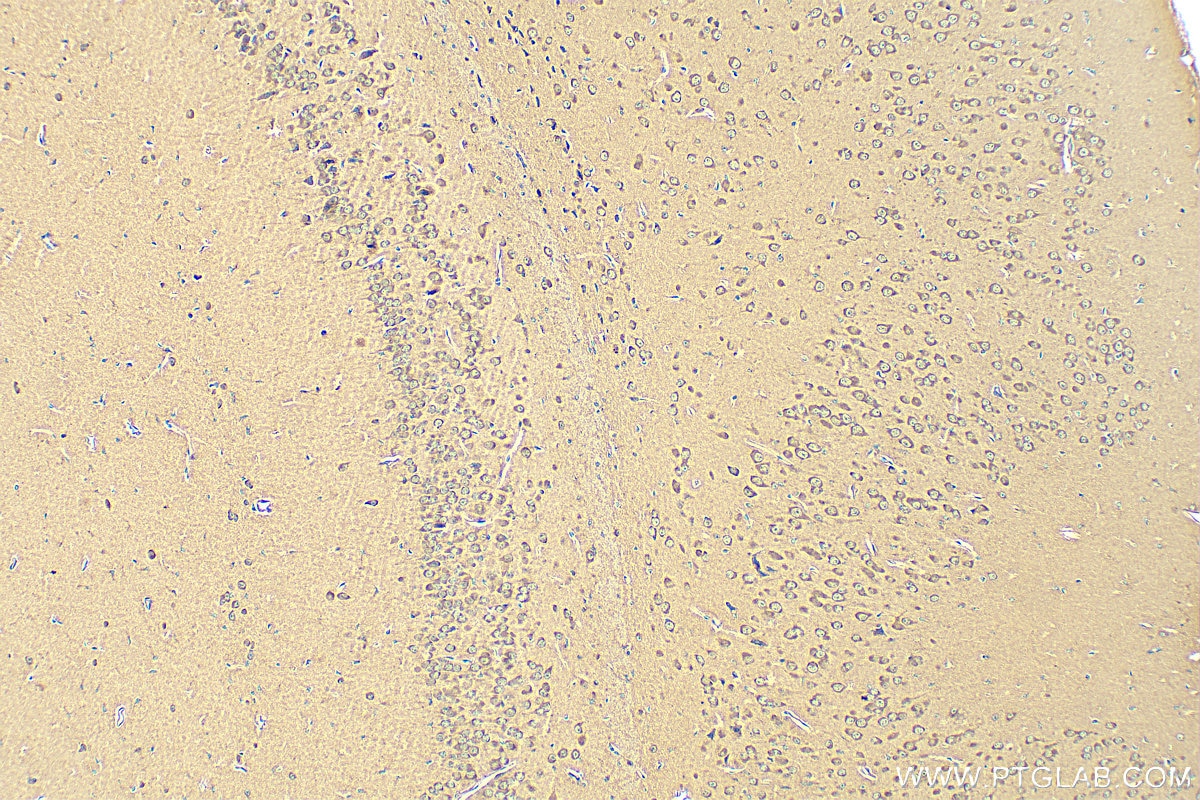 Immunohistochemistry (IHC) staining of mouse brain tissue using EIF2S1 Recombinant antibody (82936-1-RR)
