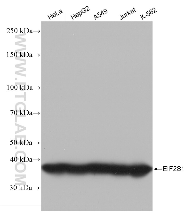 Western Blot (WB) analysis of various lysates using EIF2S1 Recombinant antibody (82936-1-RR)