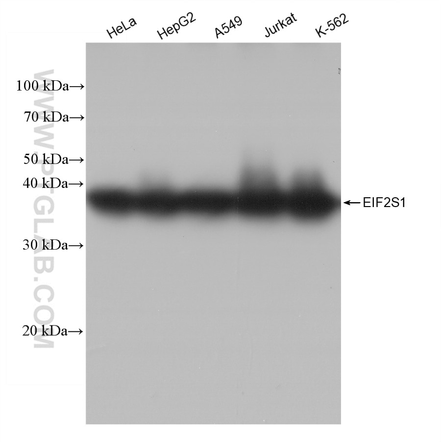 Western Blot (WB) analysis of various lysates using EIF2S1 Recombinant antibody (82936-1-RR)