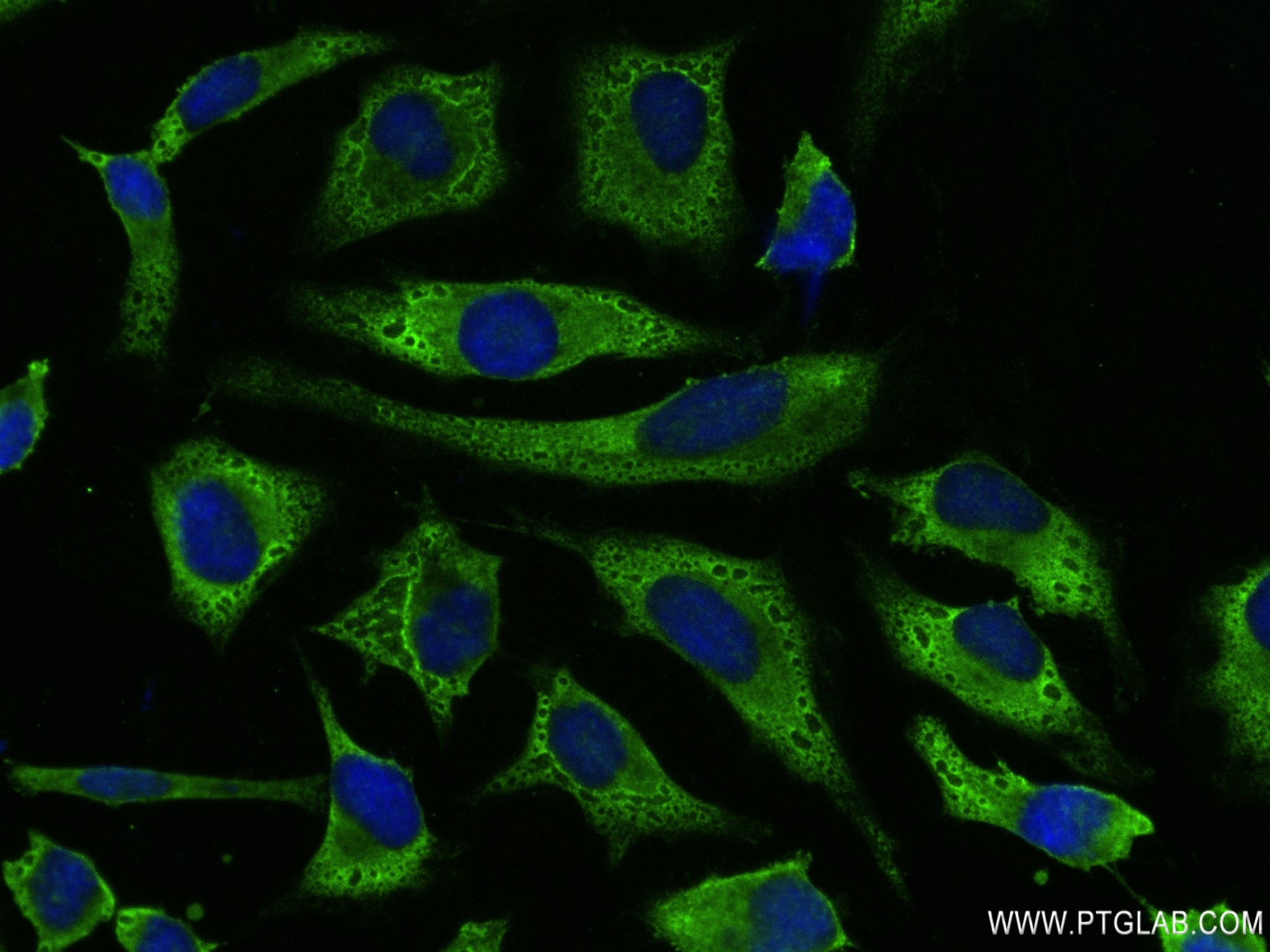 IF Staining of HeLa using 82936-8-RR