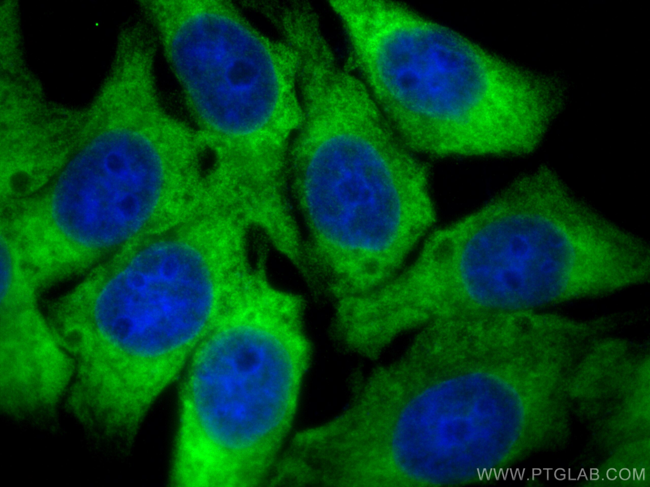 Immunofluorescence (IF) / fluorescent staining of HepG2 cells using EIF2S1 Rabbit PolyAb (RMX00004)