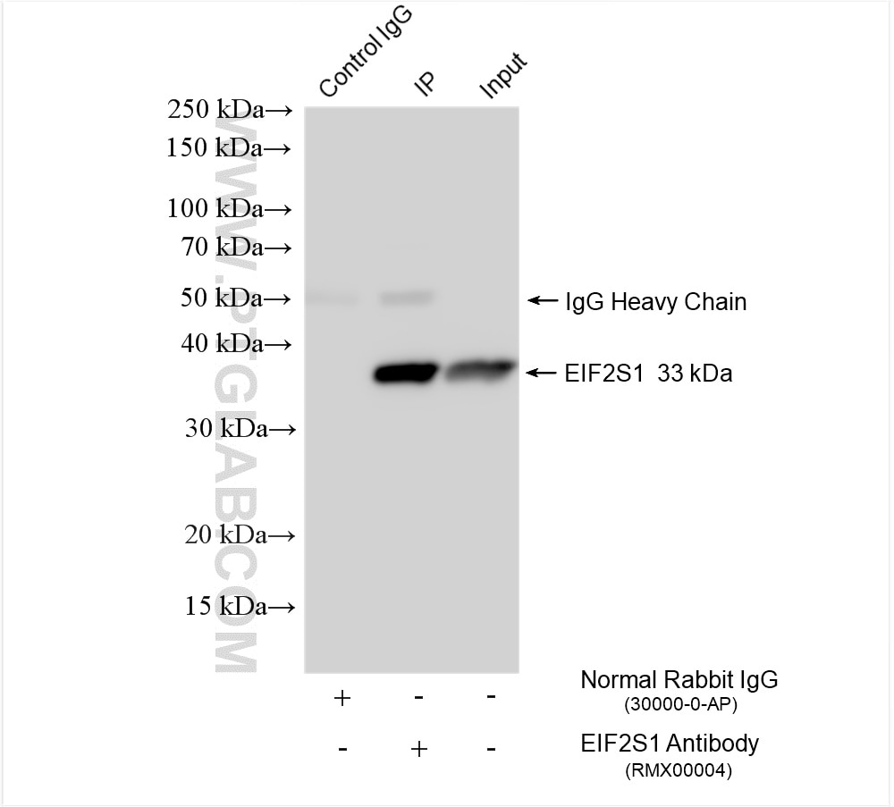 Immunoprecipitation (IP) experiment of HepG2 cells using EIF2S1 Rabbit PolyAb (RMX00004)