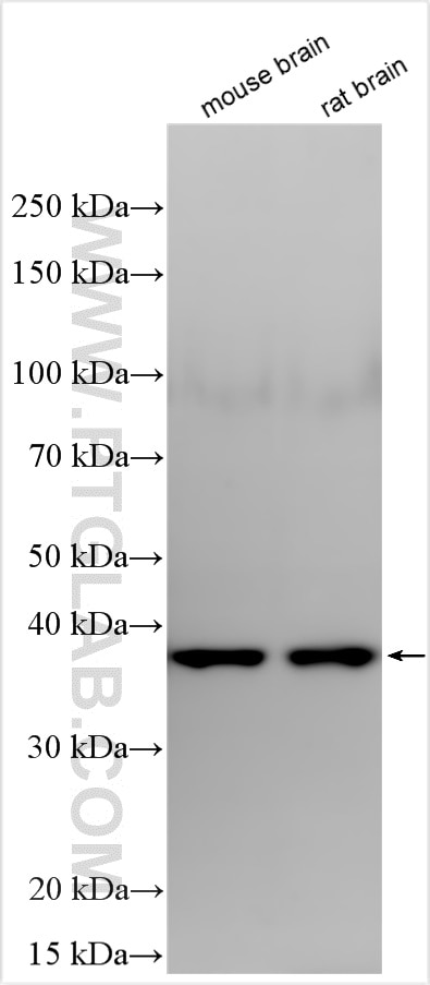 EIF2S1