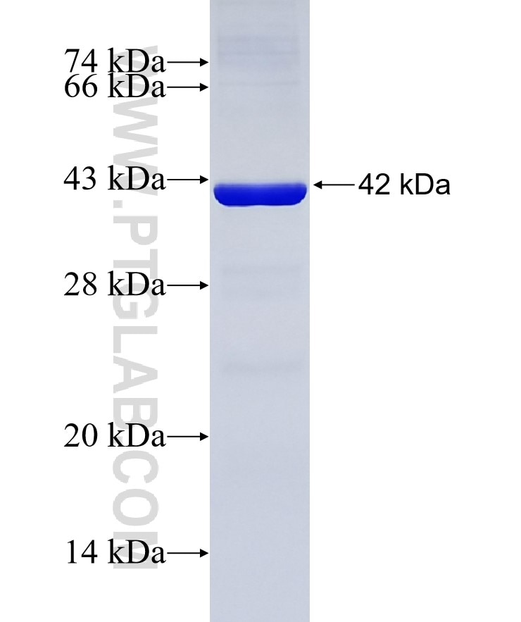 EIF2S1 fusion protein Ag28309 SDS-PAGE