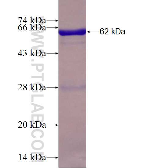 EIF2S1 fusion protein Ag1645 SDS-PAGE
