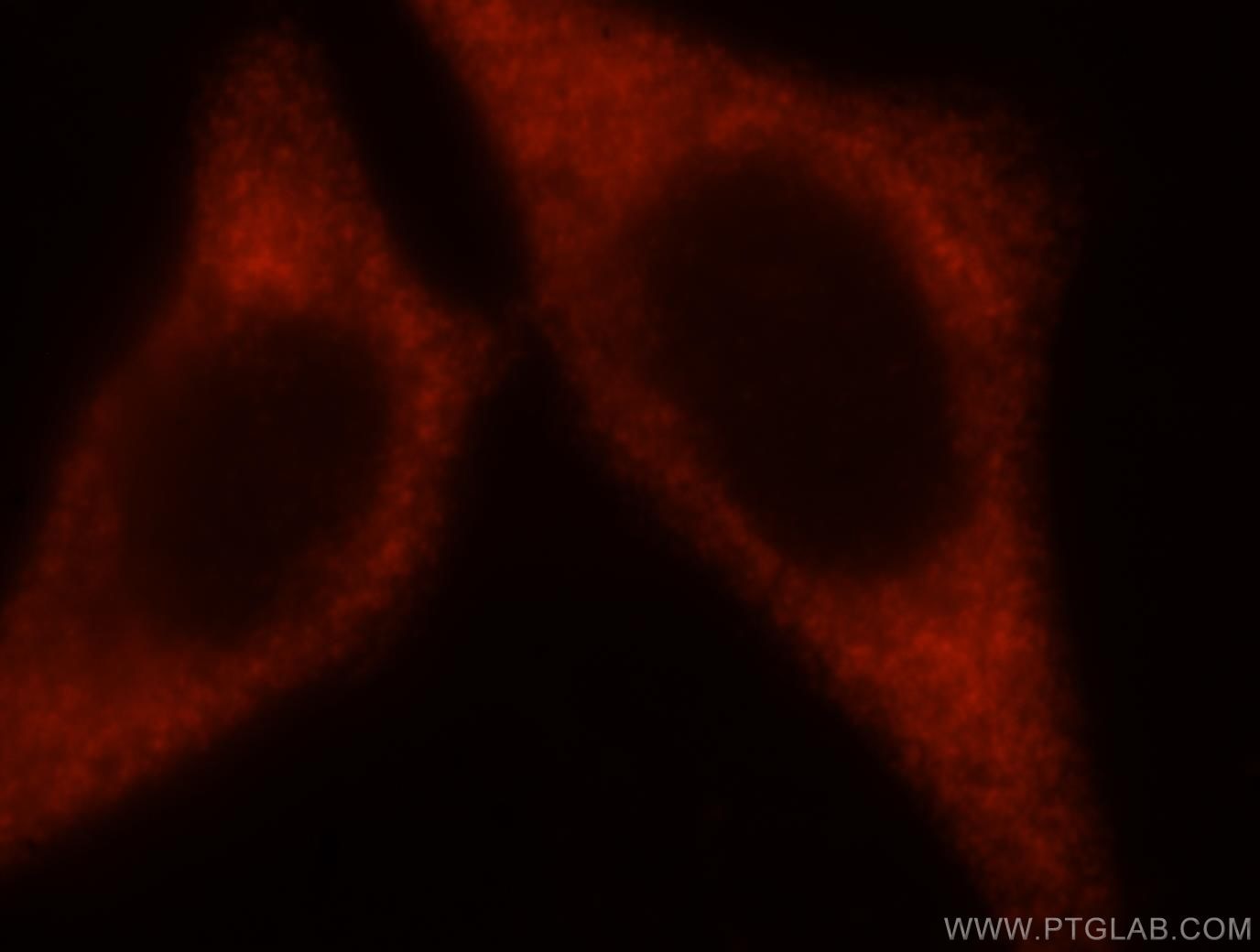 Immunofluorescence (IF) / fluorescent staining of HepG2 cells using EIF2S2 Polyclonal antibody (10227-1-AP)