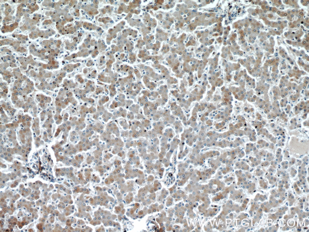 Immunohistochemistry (IHC) staining of human liver tissue using EIF2S2 Polyclonal antibody (10227-1-AP)