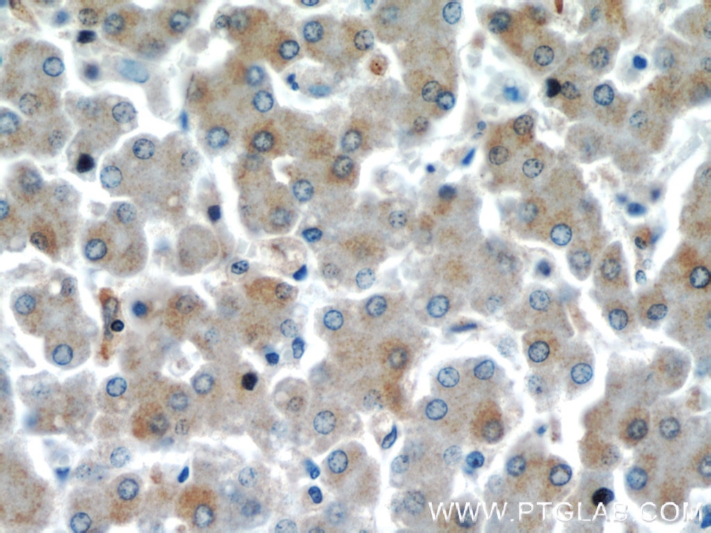Immunohistochemistry (IHC) staining of human liver tissue using EIF2S2 Polyclonal antibody (10227-1-AP)