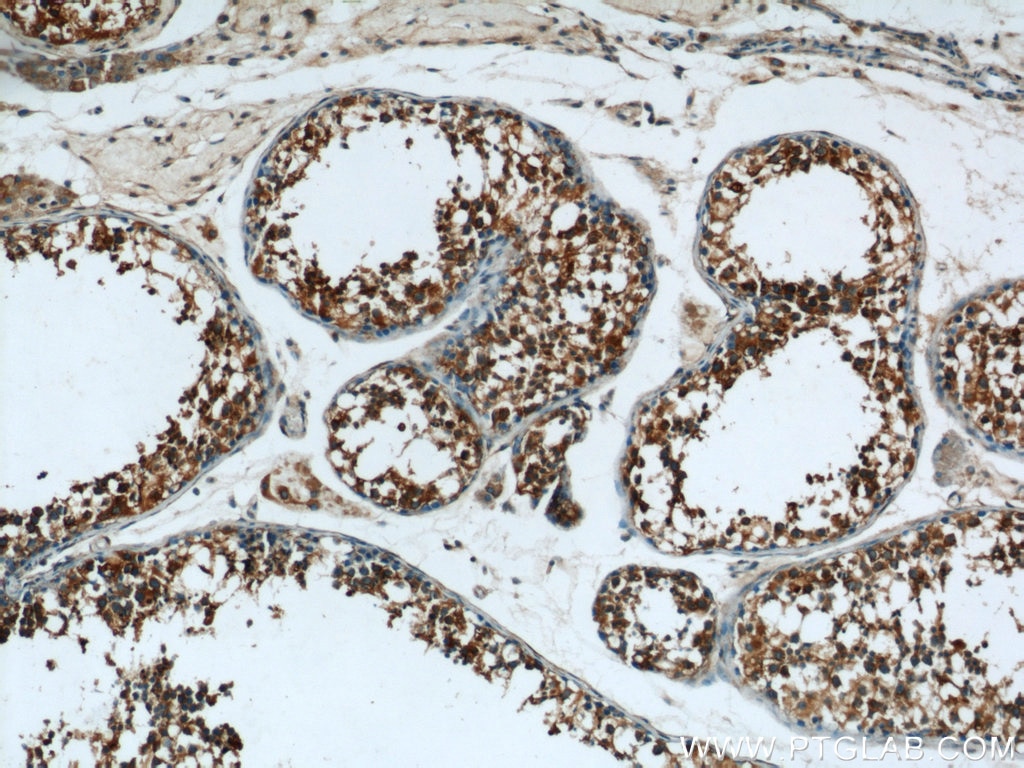 Immunohistochemistry (IHC) staining of human testis tissue using EIF2S2 Polyclonal antibody (10227-1-AP)