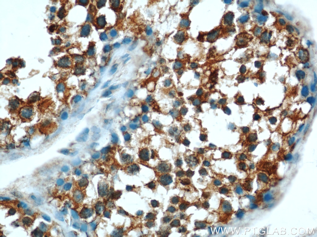 Immunohistochemistry (IHC) staining of human testis tissue using EIF2S2 Polyclonal antibody (10227-1-AP)