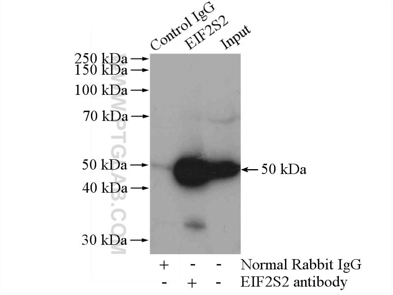 Immunoprecipitation (IP) experiment of mouse liver tissue using EIF2S2 Polyclonal antibody (10227-1-AP)