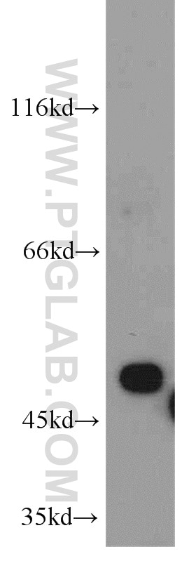 Western Blot (WB) analysis of mouse liver tissue using EIF2S2 Polyclonal antibody (10227-1-AP)