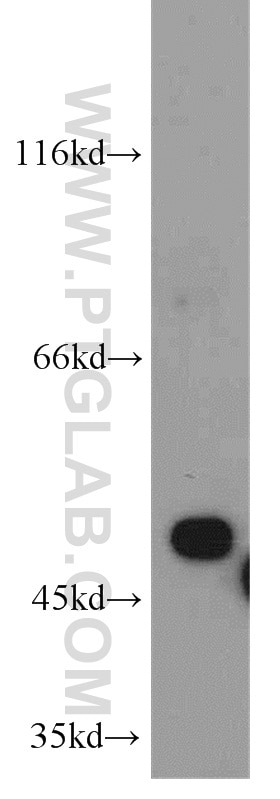 WB analysis of mouse liver using 10227-1-AP