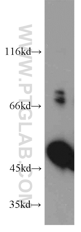 Western Blot (WB) analysis of HeLa cells using EIF2S2 Polyclonal antibody (10227-1-AP)