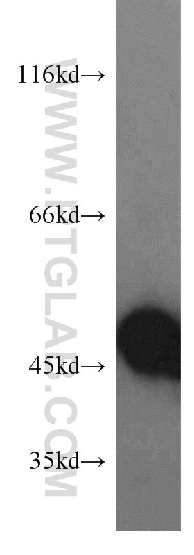 Western Blot (WB) analysis of PC-3 cells using EIF2S2 Polyclonal antibody (10227-1-AP)