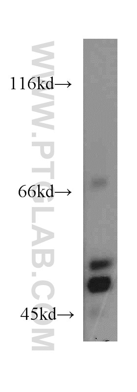 Western Blot (WB) analysis of mouse testis tissue using EIF2S2 Polyclonal antibody (10227-1-AP)