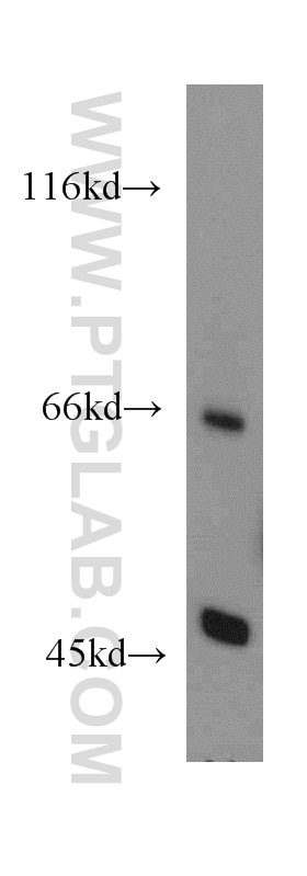 Western Blot (WB) analysis of mouse liver tissue using EIF2S2 Polyclonal antibody (10227-1-AP)