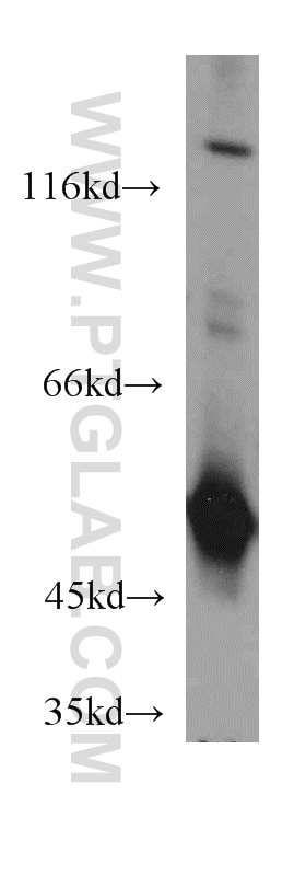 Western Blot (WB) analysis of HeLa cells using EIF2S2 Polyclonal antibody (10227-1-AP)