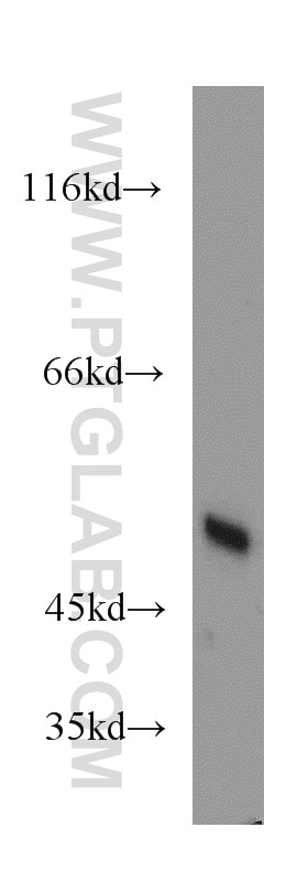 Western Blot (WB) analysis of PC-3 cells using EIF2S2 Polyclonal antibody (10227-1-AP)