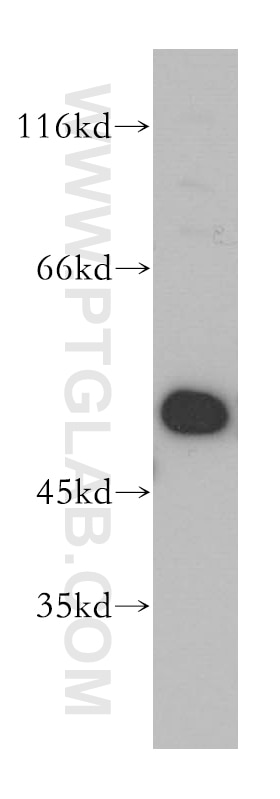 Western Blot (WB) analysis of HeLa cells using EIF2S2 Polyclonal antibody (10227-1-AP)