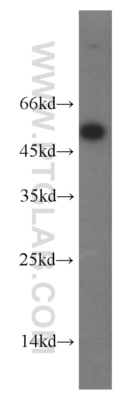 Western Blot (WB) analysis of PC-3 cells using EIF2S2 Polyclonal antibody (10227-1-AP)