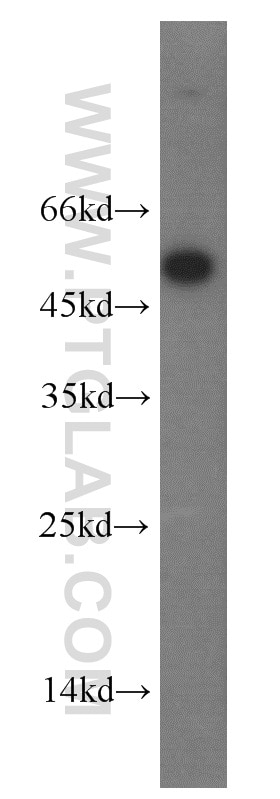 WB analysis of PC-3 using 10227-1-AP